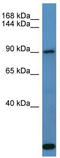 Collagen Type XXVII Alpha 1 Chain antibody, TA342817, Origene, Western Blot image 