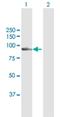 Calpain 7 antibody, H00023473-D01P, Novus Biologicals, Western Blot image 