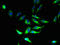 Proteolipid Protein 1 antibody, LS-C397010, Lifespan Biosciences, Immunofluorescence image 