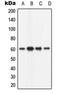 Calcium/Calmodulin Dependent Protein Kinase II Beta antibody, LS-C351899, Lifespan Biosciences, Western Blot image 