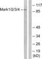 Microtubule Affinity Regulating Kinase 1 antibody, PA5-38673, Invitrogen Antibodies, Western Blot image 