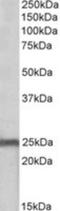 NADH:Ubiquinone Oxidoreductase Core Subunit S8 antibody, NBP1-49847, Novus Biologicals, Western Blot image 