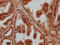 Pyrophosphatase (Inorganic) 2 antibody, LS-C681102, Lifespan Biosciences, Immunohistochemistry paraffin image 