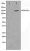 Platelet Derived Growth Factor Receptor Alpha antibody, TA347459, Origene, Western Blot image 