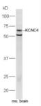 Potassium Voltage-Gated Channel Subfamily C Member 4 antibody, orb6285, Biorbyt, Western Blot image 