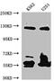 BUB1 Mitotic Checkpoint Serine/Threonine Kinase B antibody, CSB-RA263021A0HU, Cusabio, Western Blot image 