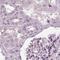 BFSP1 antibody, NBP1-91903, Novus Biologicals, Immunohistochemistry paraffin image 