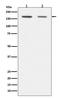 DNA Methyltransferase 1 antibody, M00172, Boster Biological Technology, Western Blot image 