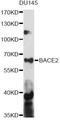 Beta-secretase 2 antibody, LS-C749845, Lifespan Biosciences, Western Blot image 