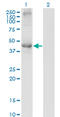 Transcobalamin 2 antibody, LS-C198317, Lifespan Biosciences, Western Blot image 