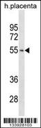 RISC-loading complex subunit TARBP2 antibody, 57-481, ProSci, Western Blot image 