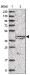 Lipoyltransferase 1, mitochondrial antibody, NBP1-92073, Novus Biologicals, Western Blot image 