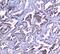 Sorcin antibody, A00222, Boster Biological Technology, Immunohistochemistry paraffin image 