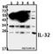 Interleukin 32 antibody, A03286-3, Boster Biological Technology, Western Blot image 