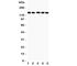 Collagen Type II Alpha 1 Chain antibody, R31259, NSJ Bioreagents, Western Blot image 