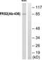 Lysophosphatidic acid receptor 5 antibody, TA315647, Origene, Western Blot image 