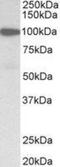 Gelsolin antibody, NBP2-27566, Novus Biologicals, Western Blot image 