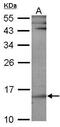 Ubiquitin Conjugating Enzyme E2 B antibody, PA5-21316, Invitrogen Antibodies, Western Blot image 