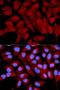 Eukaryotic Translation Initiation Factor 5A antibody, LS-C331828, Lifespan Biosciences, Immunofluorescence image 