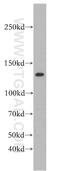 Period Circadian Regulator 2 antibody, 20359-1-AP, Proteintech Group, Western Blot image 