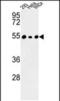 Protein Phosphatase 1 Regulatory Subunit 36 antibody, PA5-49663, Invitrogen Antibodies, Western Blot image 