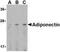 Adiponectin, C1Q And Collagen Domain Containing antibody, PA1-84881, Invitrogen Antibodies, Western Blot image 