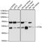 Cathepsin A antibody, STJ27454, St John