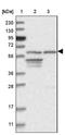 Integrator Complex Subunit 11 antibody, NBP1-85475, Novus Biologicals, Western Blot image 