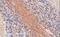 Synaptosome Associated Protein 25 antibody, GTX89577, GeneTex, Immunohistochemistry paraffin image 