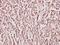 Creatine Kinase, Mitochondrial 2 antibody, A11457-1, Boster Biological Technology, Immunohistochemistry paraffin image 