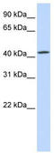Transmembrane Protein 248 antibody, TA342351, Origene, Western Blot image 
