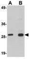 Sirtuin 6 antibody, GTX17089, GeneTex, Western Blot image 