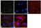 Adaptor Related Protein Complex 2 Subunit Alpha 1 antibody, MA1-064, Invitrogen Antibodies, Immunofluorescence image 