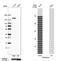 Protein Phosphatase 2 Regulatory Subunit B''Alpha antibody, NBP1-87233, Novus Biologicals, Western Blot image 