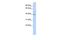 Potassium Two Pore Domain Channel Subfamily K Member 9 antibody, GTX47674, GeneTex, Western Blot image 