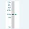 Metallothionein 3 antibody, H00004504-M01A, Novus Biologicals, Western Blot image 