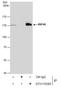 Ring Finger Protein 40 antibody, GTX115295, GeneTex, Immunoprecipitation image 