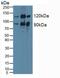 Protein Kinase C Epsilon antibody, MBS2002567, MyBioSource, Western Blot image 