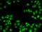 Heterogeneous Nuclear Ribonucleoprotein M antibody, 22-568, ProSci, Immunohistochemistry frozen image 