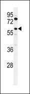 Acyl-CoA Synthetase Bubblegum Family Member 2 antibody, 64-149, ProSci, Western Blot image 