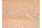 Huntingtin antibody, 5656S, Cell Signaling Technology, Immunohistochemistry paraffin image 