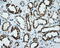 Serine Racemase antibody, M02660, Boster Biological Technology, Immunohistochemistry paraffin image 