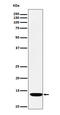 Ferredoxin 1 antibody, M05441, Boster Biological Technology, Western Blot image 