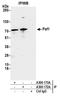 PAF1 Homolog, Paf1/RNA Polymerase II Complex Component antibody, A300-172A, Bethyl Labs, Immunoprecipitation image 