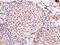 Crumbs Cell Polarity Complex Component 2 antibody, orb182732, Biorbyt, Immunohistochemistry paraffin image 