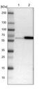 Seryl-TRNA Synthetase 2, Mitochondrial antibody, PA5-53521, Invitrogen Antibodies, Western Blot image 