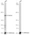 Nuclear Receptor Coactivator 3 antibody, NBP1-33720, Novus Biologicals, Western Blot image 