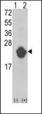 Interleukin 1 Receptor Antagonist antibody, 62-282, ProSci, Western Blot image 