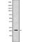 Colony Stimulating Factor 3 antibody, abx149575, Abbexa, Western Blot image 