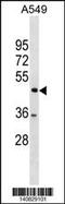 TSPY Like 1 antibody, 60-662, ProSci, Western Blot image 